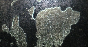 Image: construction sites filled with smaller spheres, all of which can grow more filaments and hydr