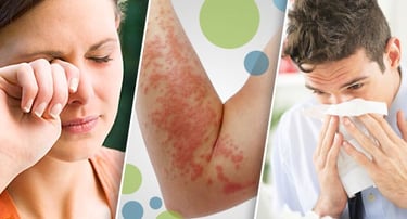 Personas con alergias a los ácaros. 