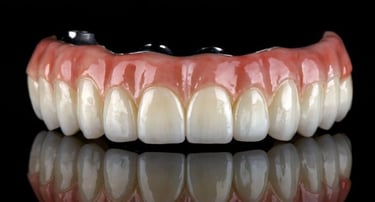 Zirconia Pretteau fixed bridge for the All on 4 procedure