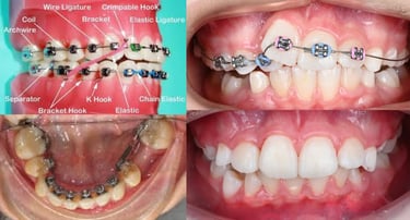 Descubra los 10 principales beneficios comprobados de la ortodoncia, verificados por autoridades mun