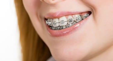 braces orthodontic treatment to correct bite and smile beautifully