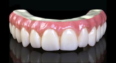 Crystal Ultra fixed bridge supported by implants