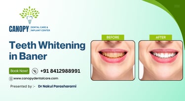 teeth whitening in baner