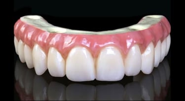 Crystal Ultra fixed bridge supported by implants