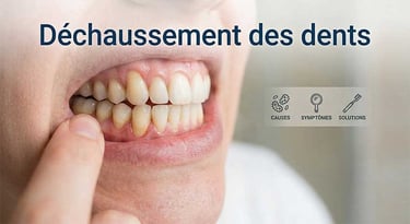 Image de déchaussement des dents