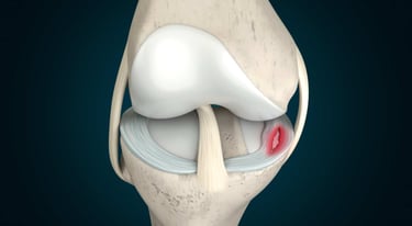 Dr.Rajinikanth's ortho clinic meniscuc teat