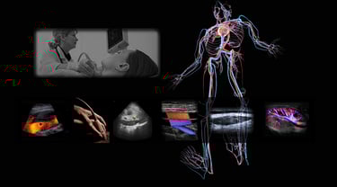Image showing vascular anatomy and various images of ultrasound vascular imaging and Doppler.