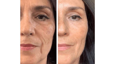 Elixir da Beleza 02- Skinbooster 