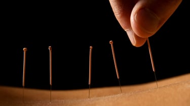Acupuncture Crolles RDV en ligne