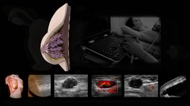 Breast ultrasound images.