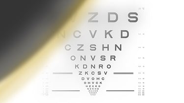 Curtain like appearance suggesting retinal detachment.