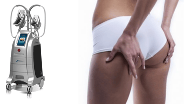Cryolipolise, minceur