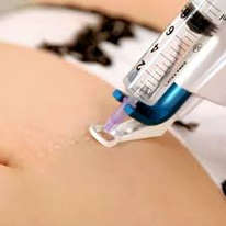 mésothérapie 