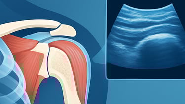 Ecografia muscolo scheletrica Qualiano. Tendiniti Borsiti Dott. Picascia