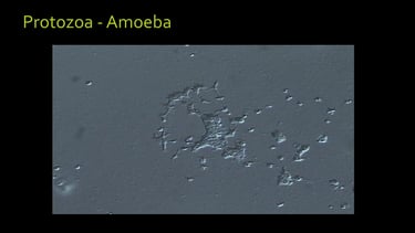 microscope image of a living Soil Amoeba