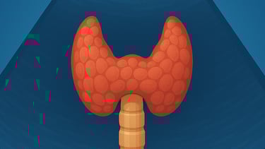 Ecografia tiroidea Qualiano - Controllo tiroide e noduli presso studio Dott. Picascia