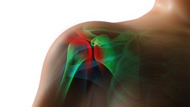 Dr.Rajinikanth's ortho clinic frozen shoulder