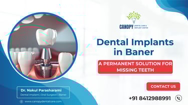 Dental Implants in Baner