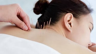 dry needling therapy for cervical pain to release trigger points.