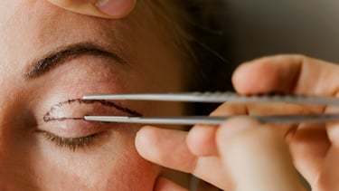 Dra. Lilyan Marissel - Cirugía Plástica y Estética - blefaroplastia