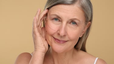 Dra. Lilyan Marissel - Cirugía Plástica y Estética - lifting-facial- rejuvenecimiento