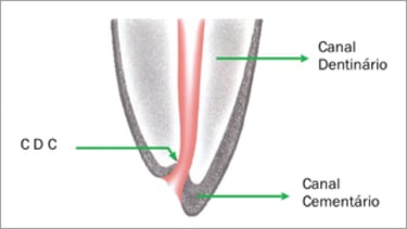 limite cdc preparo biomecânico endodontia resumo concurso odontologia