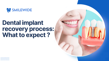 A person holding dental implant model explaining dental implant recovery process