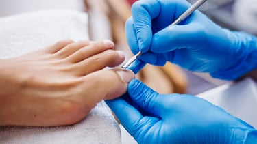 Profilaxia | Talitha Miquelanti - Podóloga em Uberlândia | Podologia em Uberlândia