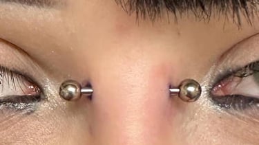 A close-up of a symmetrical bridge piercing with titanium barbells. The jewellery sits evenly across