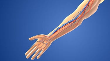 haemodialysis bruit avf dialysis ultrasound vascular artery vein arteriovenous fistula diabetes kidney failure renal disease