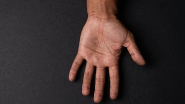 Flat lay of an open hand palm-up on a matte black surface, fingers spread slightly, studio top light casting minimal shadow, all four fingers and thumb visible showing relative proportions, skin tone warm olive