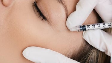 Reduccion de arrugas, rejuvenecimiento facial.