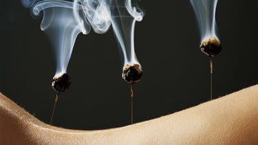 Acupuncture Montauban