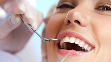 Planos odontológicos que cabem no seu bolso