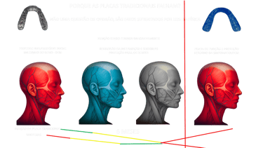 as melhores placas para bruxismo , placas Ortoscience, placas polyceram