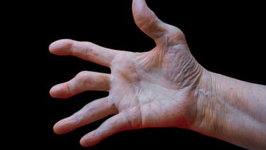 Alivio del dolor articular por artrosis con fisioterapia en Toledo