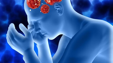 Demyelinating Diseases