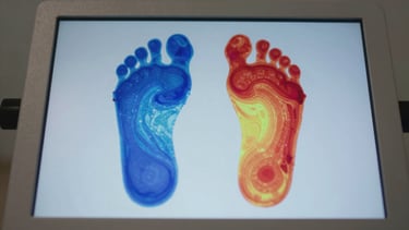 Close-up top-down view of a baropodometry scan result displayed on a clinical light table — a pressure distribution footprint map in high-contrast thermal color gradient (blue to red), precise and diagnostic. North-facing studio light, no shadows, clinical documentation aesthetic.