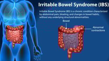 GASTRO FOUNDATION irritable bowel syndrome