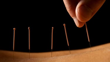 Acupuncture Crolles RDV en ligne