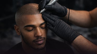 Professional scalp micropigmentation procedure creating a natural hairline for a man with thinning hair.