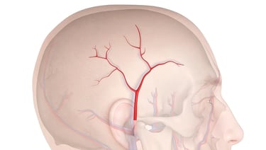 vascular ultrasound artery temporal facial parietal giant cell arteritis pain face vision jaw symptoms polymyalgia rheumatica