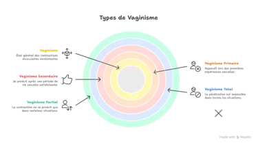 Types de vaginisme, sante sexuelle, recherchesante.com
