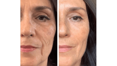 Elixir da Beleza 01- Skinbooster