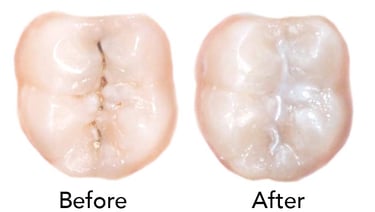 sealants