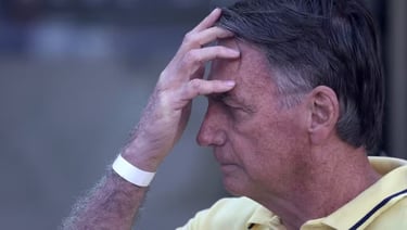 Jair Bolsonaro de amaraelo com a mão na testa