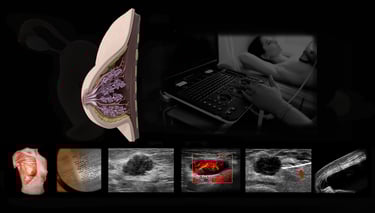 Breast ultrasound images.
