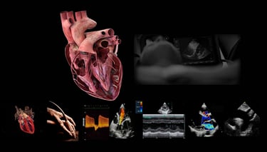 Panel of anatomy and hands-on echocardiographic cardiac ultrasound images. 