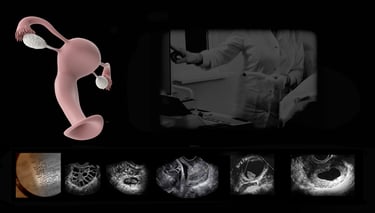 Image showing the uterus and ovaries with various ultrasound images and Doppler of same.