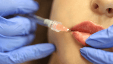 Remodelagem labial